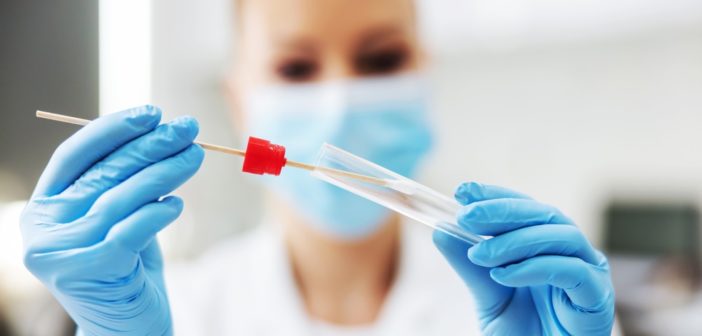 nota-tecnica-test-covid