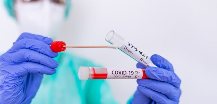 test-covid